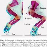 Cissus Quadrangularis extract during pregnancy stimulates fetal bone growth