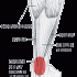 Cissus and Muscle, Tendon, Ligament Repair