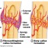 Cissus Quadrangularis – An Effective Bone Healer